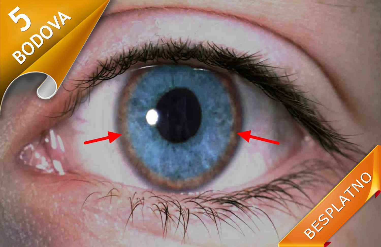 WILSONOVA BOLEST – SAVREMENI PRISTUPI DIJAGNOSTICI I TERAPIJI